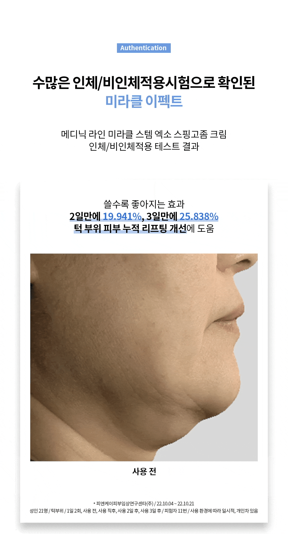miracle cream_11